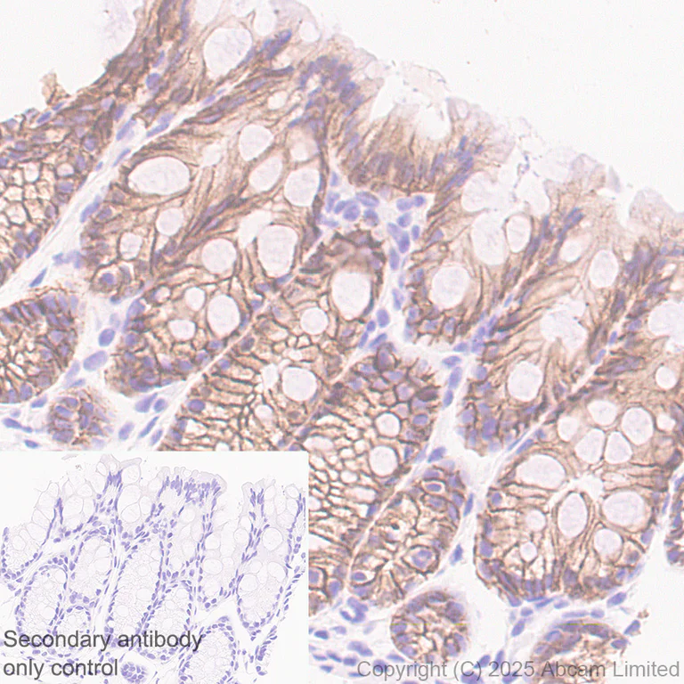 Immunohistochemistry (Formalin/PFA-fixed paraffin-embedded sections) - Anti-E Cadherin antibody [EPR30045-525] - BSA and Azide free (AB324198)