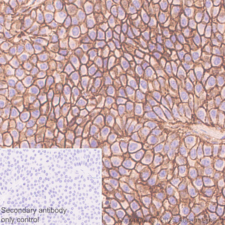 Immunohistochemistry (Formalin/PFA-fixed paraffin-embedded sections) - Anti-E Cadherin antibody [EPR30045-525] - BSA and Azide free (AB324198)