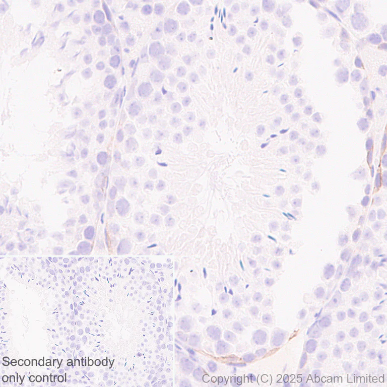 Immunohistochemistry (Formalin/PFA-fixed paraffin-embedded sections) - Anti-E Cadherin antibody [EPR30045-525] - BSA and Azide free (AB324198)