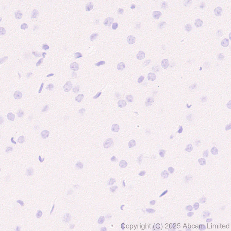 Immunohistochemistry (Formalin/PFA-fixed paraffin-embedded sections) - Anti-E Cadherin antibody [EPR30045-525] - BSA and Azide free (AB324198)