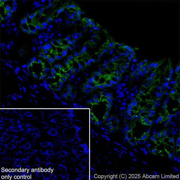 Immunohistochemistry (Frozen sections) - Anti-E Cadherin antibody [EPR30045-525] - BSA and Azide free (AB324198)