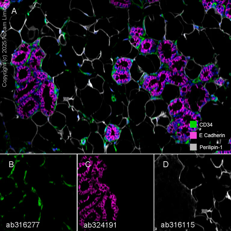 Multiplex immunohistochemistry - Anti-E Cadherin antibody [EPR30045-525] - BSA and Azide free (AB324198)