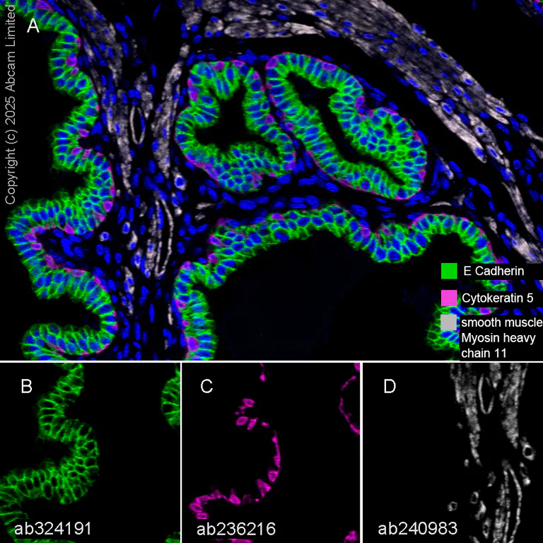 Multiplex immunohistochemistry - Anti-E Cadherin antibody [EPR30045-525] - BSA and Azide free (AB324198)