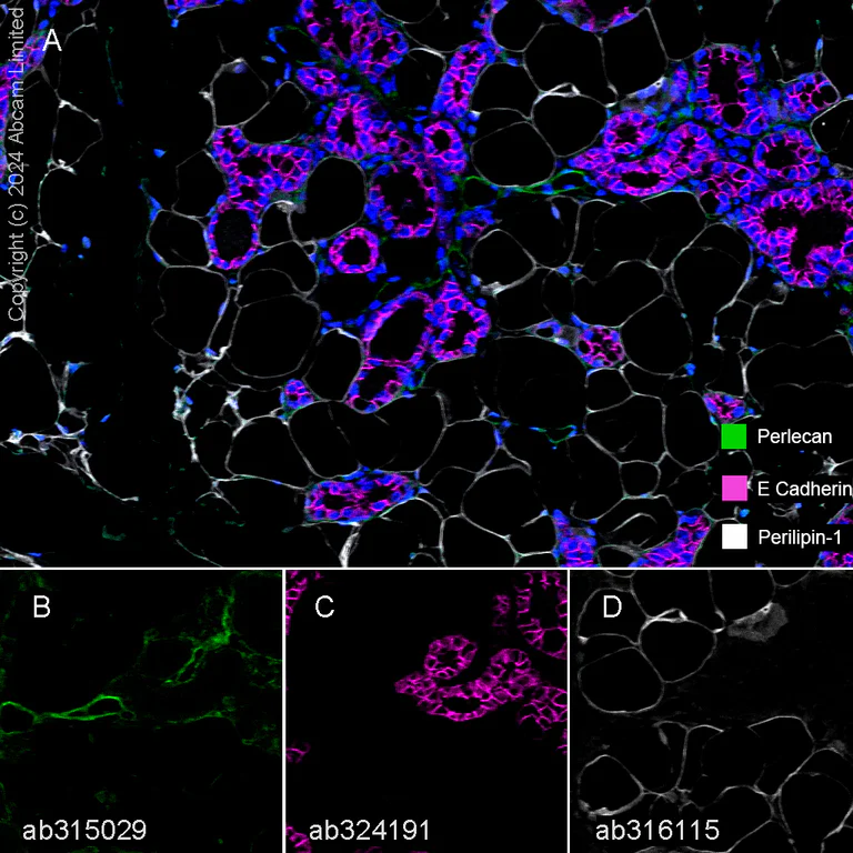 Multiplex immunohistochemistry - Anti-E Cadherin antibody [EPR30045-525] - BSA and Azide free (AB324198)