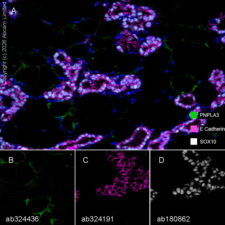 Multiplex immunohistochemistry - Anti-E Cadherin antibody [EPR30045-525] - BSA and Azide free (AB324198)