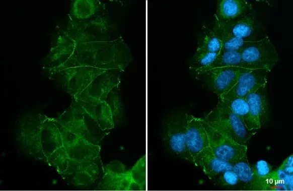 Immunocytochemistry/ Immunofluorescence - Anti-E Cadherin antibody [HL1229] (AB308347), expandable thumbnail