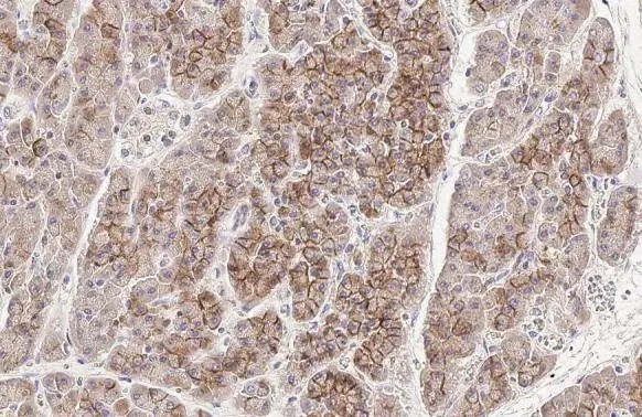 Immunohistochemistry (Formalin/PFA-fixed paraffin-embedded sections) - Anti-E Cadherin antibody [HL1229] (AB308347), expandable thumbnail