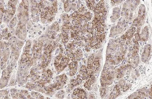 Immunohistochemistry (Formalin/PFA-fixed paraffin-embedded sections) - Anti-E Cadherin antibody [HL1229] (AB308347)