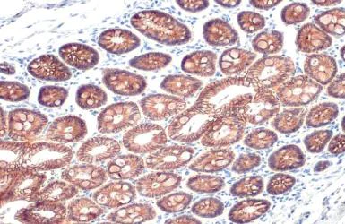 Immunohistochemistry paraffin embedded sections - Anti-E Cadherin antibody [HL1229] (AB308347)