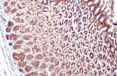 Immunohistochemistry paraffin embedded sections - Anti-E Cadherin antibody [HL1229] (ab308347), expandable thumbnail