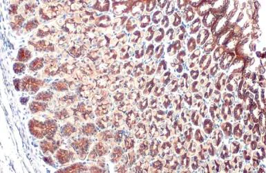 Immunohistochemistry paraffin embedded sections - Anti-E Cadherin antibody [HL1229] (AB308347)