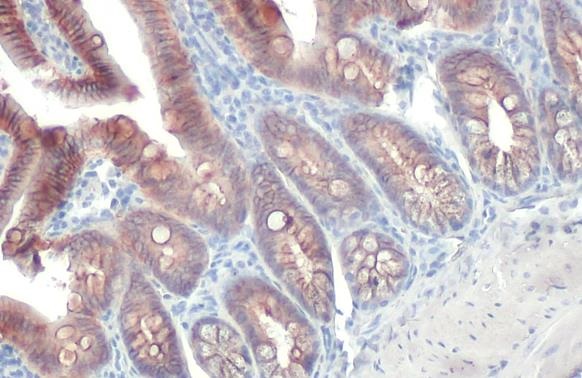Immunohistochemistry paraffin embedded sections - Anti-E Cadherin antibody [HL1229] (ab308347), expandable thumbnail
