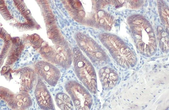 Immunohistochemistry paraffin embedded sections - Anti-E Cadherin antibody [HL1229] (AB308347)