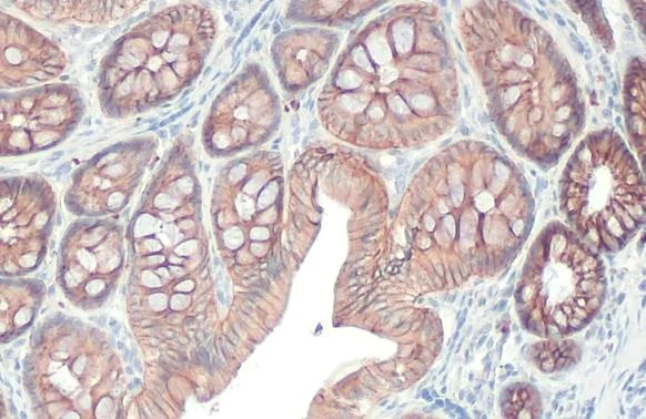 Immunohistochemistry paraffin embedded sections - Anti-E Cadherin antibody [HL1229] (AB308347)