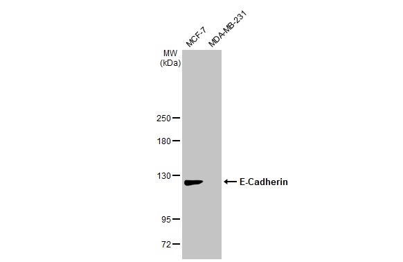 Western blot - Anti-E Cadherin antibody [HL1229] (AB308347), expandable thumbnail