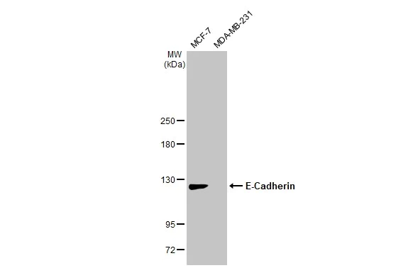 Western blot - Anti-E Cadherin antibody [HL1229] (AB308347)