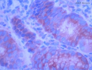 Immunohistochemistry (Formalin/PFA-fixed paraffin-embedded sections) - Anti-E Cadherin antibody - Intercellular Junction Marker (AB15148)