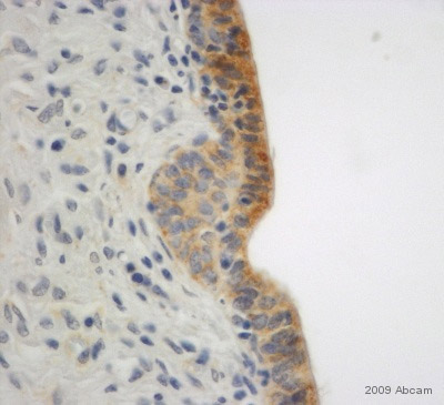 Anti-E Cadherin antibody - Intercellular Junction Marker