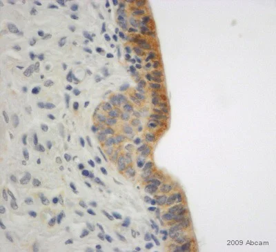 Immunohistochemistry (Formalin/PFA-fixed paraffin-embedded sections) - Anti-E Cadherin antibody - Intercellular Junction Marker (AB15148)