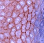 Immunohistochemistry (Formalin/PFA-fixed paraffin-embedded sections) - Anti-E Cadherin antibody - Intercellular Junction Marker (AB15148)