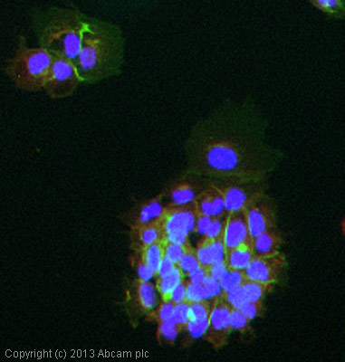 Immunocytochemistry - Anti-E Cadherin antibody [M168] - C-terminal (AB76055), expandable thumbnail