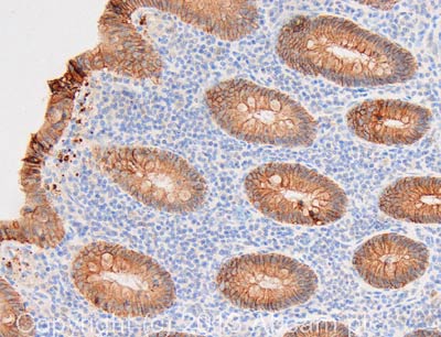 Immunohistochemistry (Formalin/PFA-fixed paraffin-embedded sections) - Anti-E Cadherin antibody [M168] - C-terminal (AB76055), expandable thumbnail