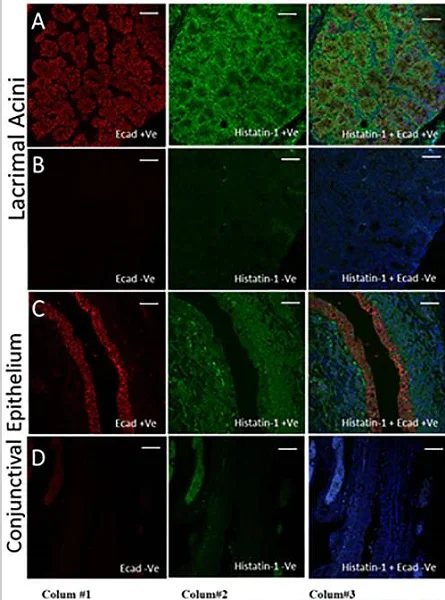 Immunohistochemistry (Formalin/PFA-fixed paraffin-embedded sections) - Anti-E Cadherin antibody [M168] - C-terminal (AB76055)