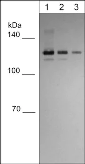 Western blot - Anti-E Cadherin antibody [M168] - C-terminal (AB76055)