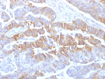 Immunohistochemistry (Formalin/PFA-fixed paraffin-embedded sections) - Anti-E Cadherin antibody [rCDH1/1525] (AB238099)