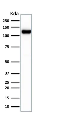 Western blot - Anti-E Cadherin antibody [rCDH1/1525] (AB238099)