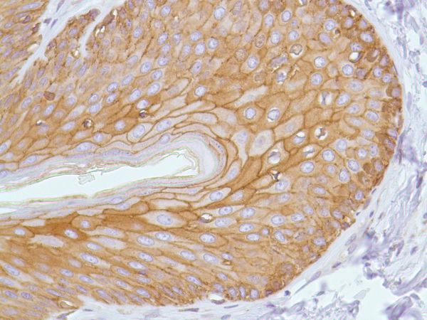 Immunohistochemistry (Formalin/PFA-fixed paraffin-embedded sections) - Anti-E Cadherin antibody [SP64] (ab227639), expandable thumbnail