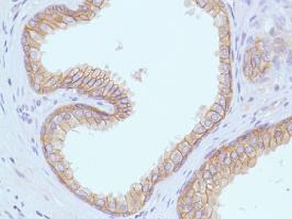 Immunohistochemistry (Formalin/PFA-fixed paraffin-embedded sections) - Anti-E Cadherin antibody [SP64] (ab227639), expandable thumbnail