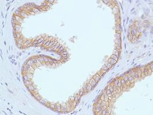 Immunohistochemistry (Formalin/PFA-fixed paraffin-embedded sections) - Anti-E Cadherin antibody [SP64] (AB227639)