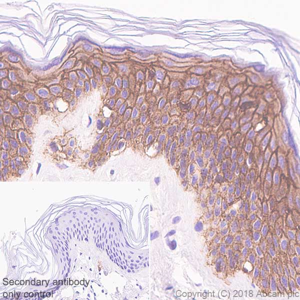Immunohistochemistry (Formalin/PFA-fixed paraffin-embedded sections) - Anti-E Cadherin antibody [SP64] (AB227639), expandable thumbnail