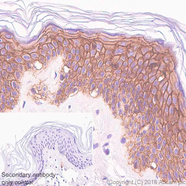 Immunohistochemistry (Formalin/PFA-fixed paraffin-embedded sections) - Anti-E Cadherin antibody [SP64] (AB227639)