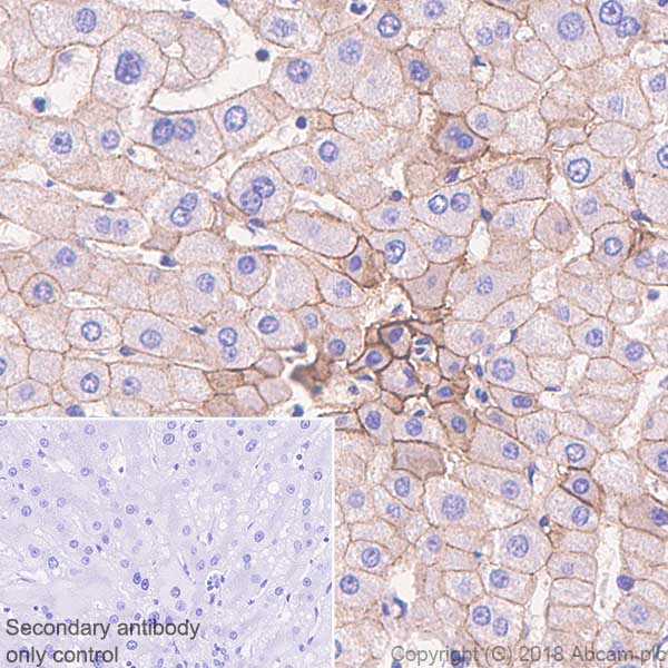 Immunohistochemistry (Formalin/PFA-fixed paraffin-embedded sections) - Anti-E Cadherin antibody [SP64] (AB227639), expandable thumbnail