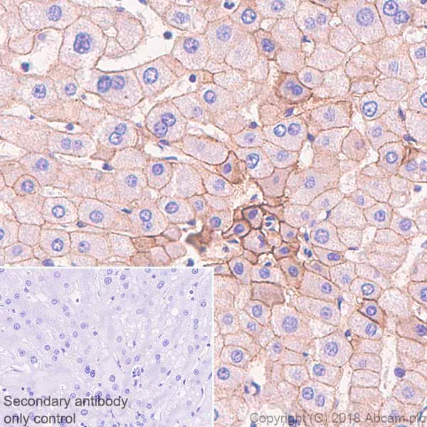 Immunohistochemistry (Formalin/PFA-fixed paraffin-embedded sections) - Anti-E Cadherin antibody [SP64] (AB227639)