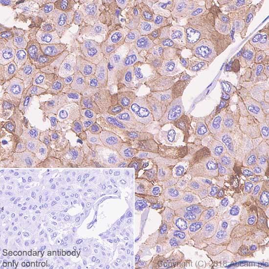Immunohistochemistry (Formalin/PFA-fixed paraffin-embedded sections) - Anti-E Cadherin antibody [SP64] (AB227639), expandable thumbnail