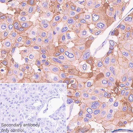 Immunohistochemistry (Formalin/PFA-fixed paraffin-embedded sections) - Anti-E Cadherin antibody [SP64] (AB227639)