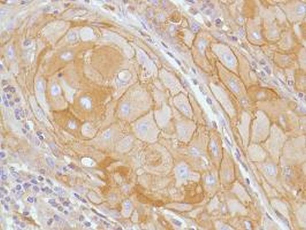 Immunohistochemistry (Formalin/PFA-fixed paraffin-embedded sections) - Anti-E Cadherin antibody [SP64] (ab227639), expandable thumbnail