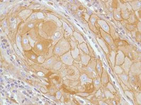 Immunohistochemistry (Formalin/PFA-fixed paraffin-embedded sections) - Anti-E Cadherin antibody [SP64] (AB227639)