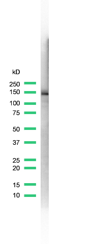 Western blot - Anti-E Cadherin antibody [SP64] (AB227639), expandable thumbnail