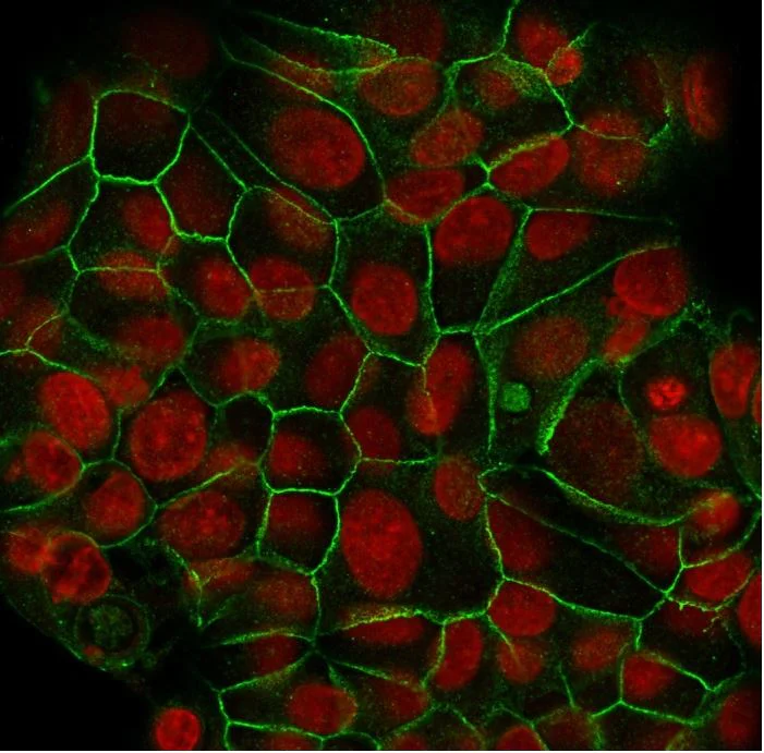 Immunocytochemistry - Anti-E Cadherin antibody [SPM471] (AB270257)