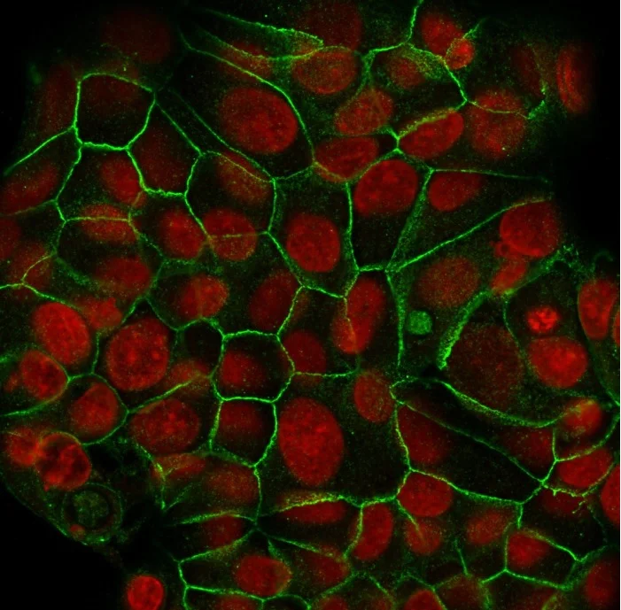 Immunocytochemistry/ Immunofluorescence - Anti-E Cadherin antibody [SPM471] - BSA and Azide free (AB270288)