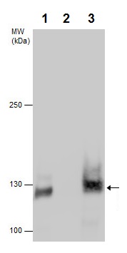 Immunoprecipitation - Anti-E Cadherin (phospho S838 + S840) antibody (AB226779)