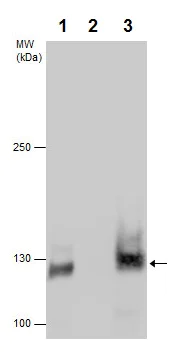 Immunoprecipitation - Anti-E Cadherin (phospho S838 + S840) antibody (AB226779)