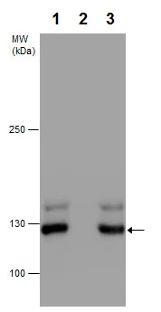 Western blot - Anti-E Cadherin (phospho S838 + S840) antibody (AB226779)