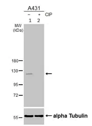 Western blot - Anti-E Cadherin (phospho S838 + S840) antibody (AB226779)