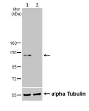Western blot - Anti-E Cadherin (phospho S838 + S840) antibody (AB226779)