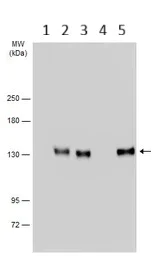 Western blot - Anti-E Cadherin (phospho S838 + S840) antibody (AB226779)
